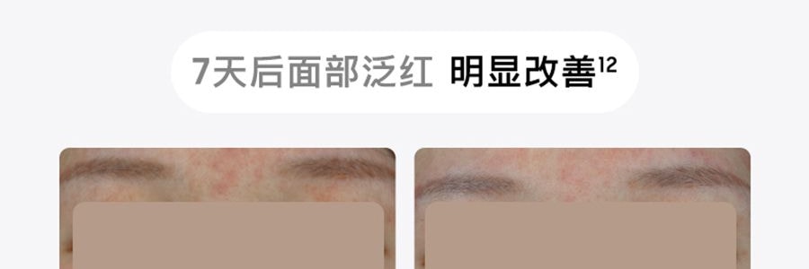 FLOSSOM花至 光能艙air王炸雙抗cp煥發舒緩紅光子嫩膚面罩美容儀大排燈 WL200 美白抗老 精準擊退乾·敏·垮·紋【李佳琦推薦】