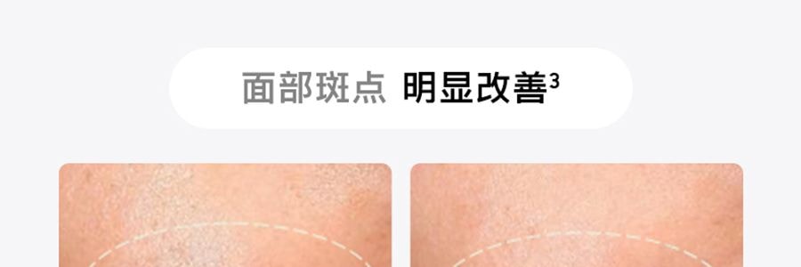 FLOSSOM花至 光能艙air王炸雙抗cp煥發舒緩紅光子嫩膚面罩美容儀大排燈 WL200 美白抗老 精準擊退乾·敏·垮·紋【李佳琦推薦】