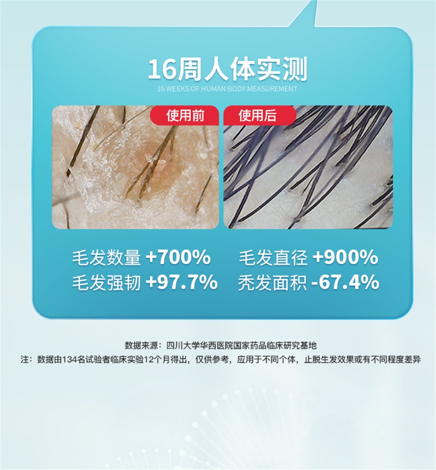 【中国直邮】斯必申  米诺地尔酊搽剂生发液女性2%防脱发生发液洗发水  100ml/瓶