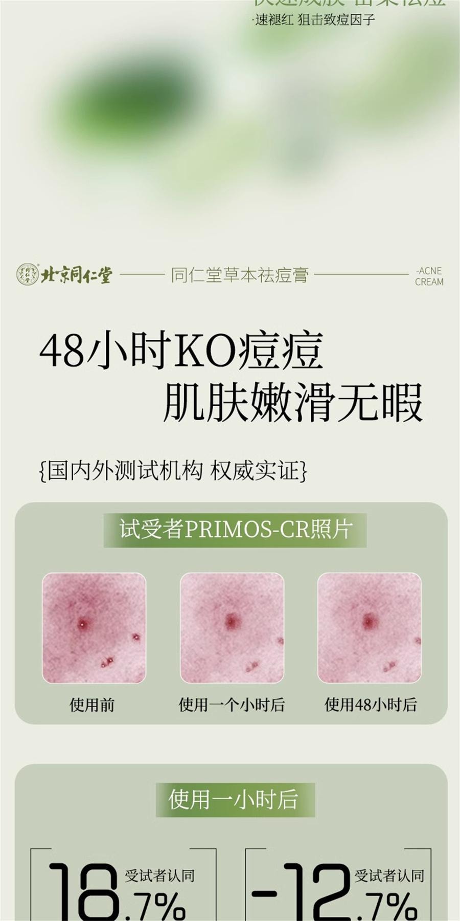 Herbal acne Cream Face for teenagers Repair anti-inflammatory acne Mark pit scar and pimple 20g/ bottle