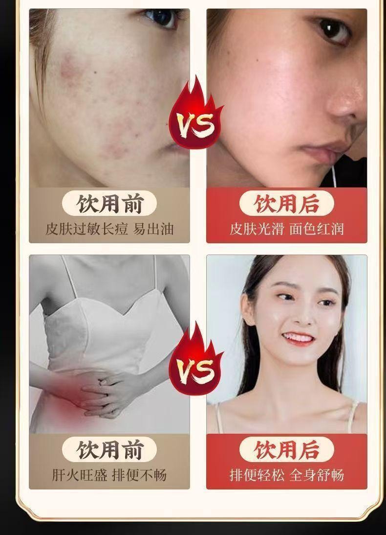 【中国直邮】 北京同仁堂 内廷上用®菊花陈皮枸杞茶 150g   熬夜眼干 清热降火