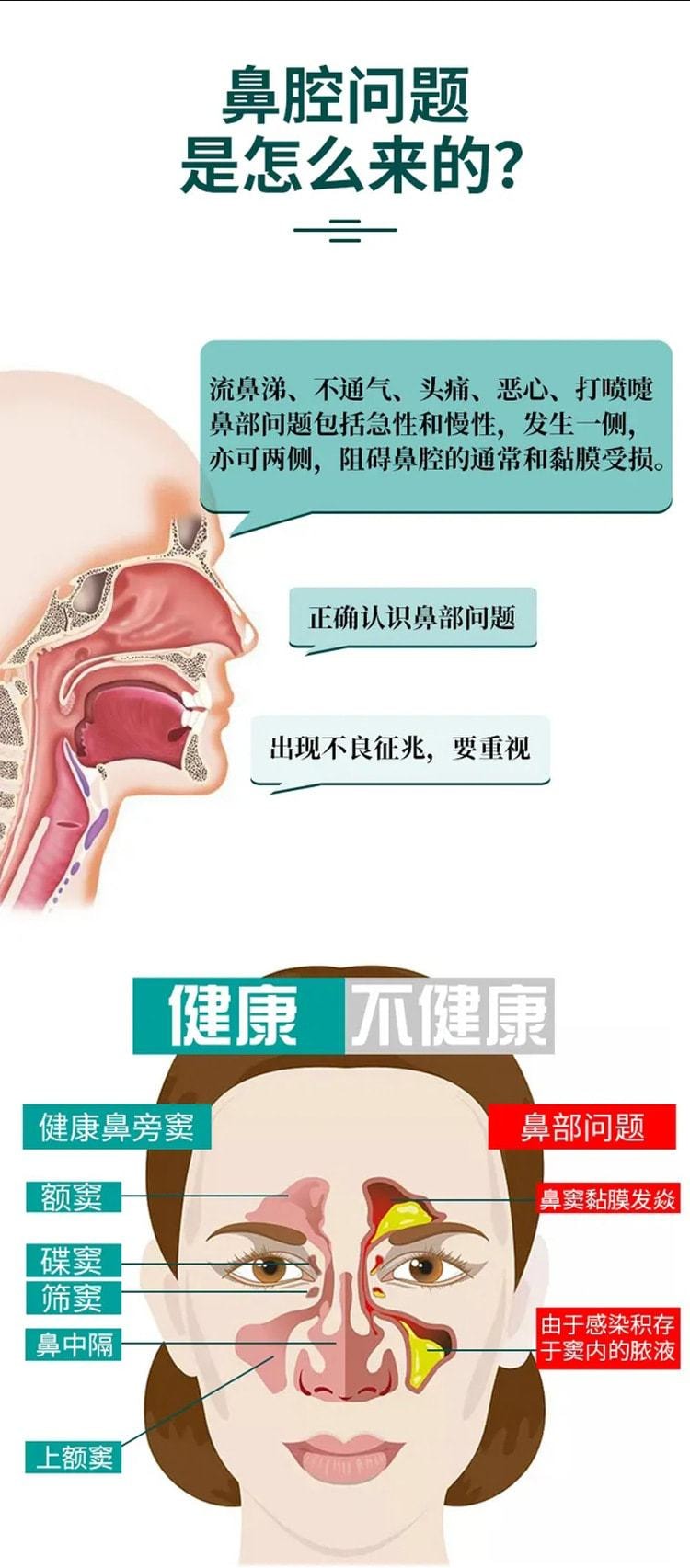 【中国直邮】严和 鼻立舒喷剂 家庭常备 适用于鼻塞痒流鼻涕 20ml/瓶