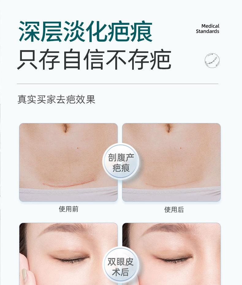 【中国直邮】 舒奈美 疤痕贴抑制疤痕增生贴疤刨腹疤痕隐形贴卷硅凝胶疤痕修复贴 (卷装)