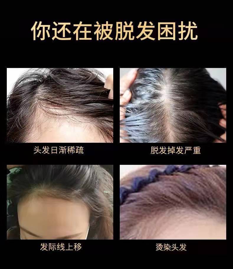 【中國直郵】北京同仁堂 防脫髮洗髮水露液固發生薑何首烏側柏葉-洗髮露200ml/瓶