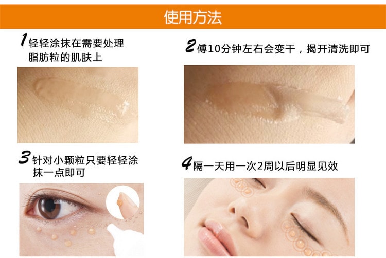 日本CHEZ MOI TSUBU NIGHT消除眼部脂肪粒藥膏軟膜 30g