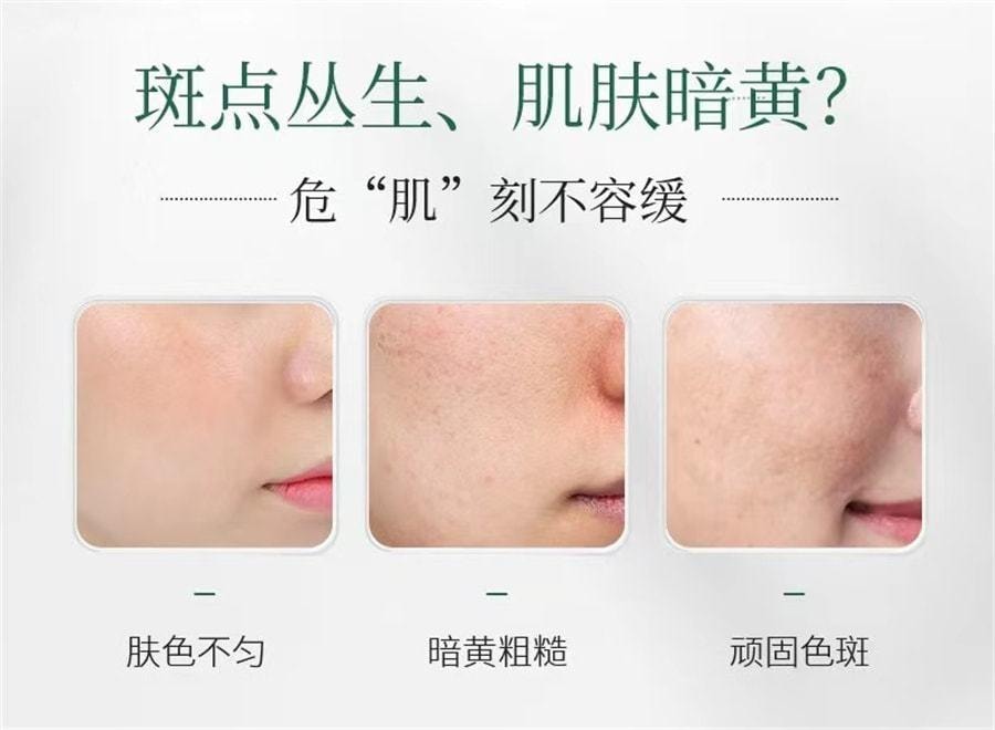 【中国直邮】 CJ 祛斑霜美白保湿补水色斑晒斑黄褐斑雀斑男女去斑神器 30g/瓶 (小红书种草推荐)