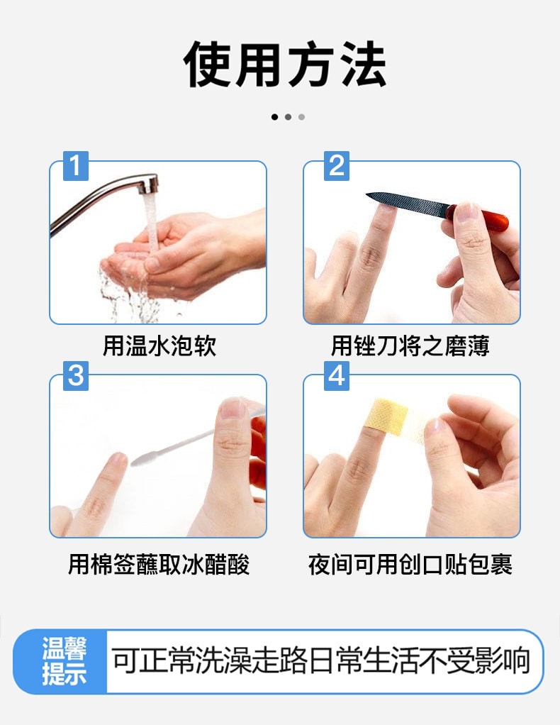 【中国直邮】 欧诺康 30%冰醋酸溶液涂剂抗菌剂 外用泡脚甲部护理 杀菌修复 100ml/盒