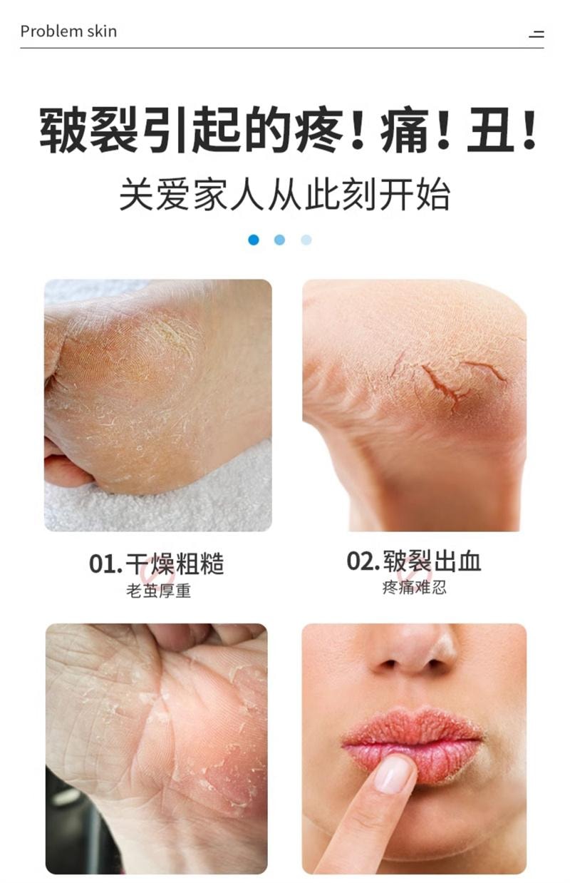 【中国直邮】 海氏海诺 医用白凡士林500ml药用纯防干裂润肤油保湿护手霜软膏润滑剂