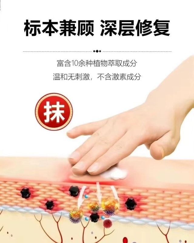 【中國直郵】 嚴和 汗疹草本乳膏 小水泡手癢皮膚搔癢蚊蟲叮咬抑菌止癢膏 15g/盒