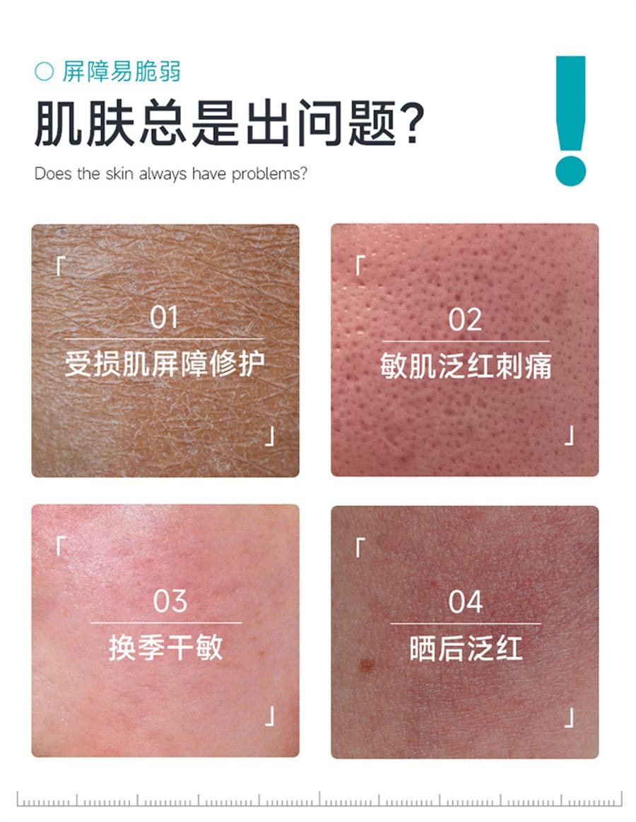 【中國直郵】 綻妍 三重蛋白精潤舒緩修護面膜 補水保濕曬後敏感泛紅肌膚屏障修護5片/盒