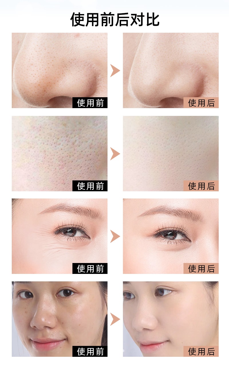 中國KAKUSAN卡酷尚新款矽膠美容面罩光子嫩膚儀光譜儀祛痘嫩膚美容儀 黑色 1件