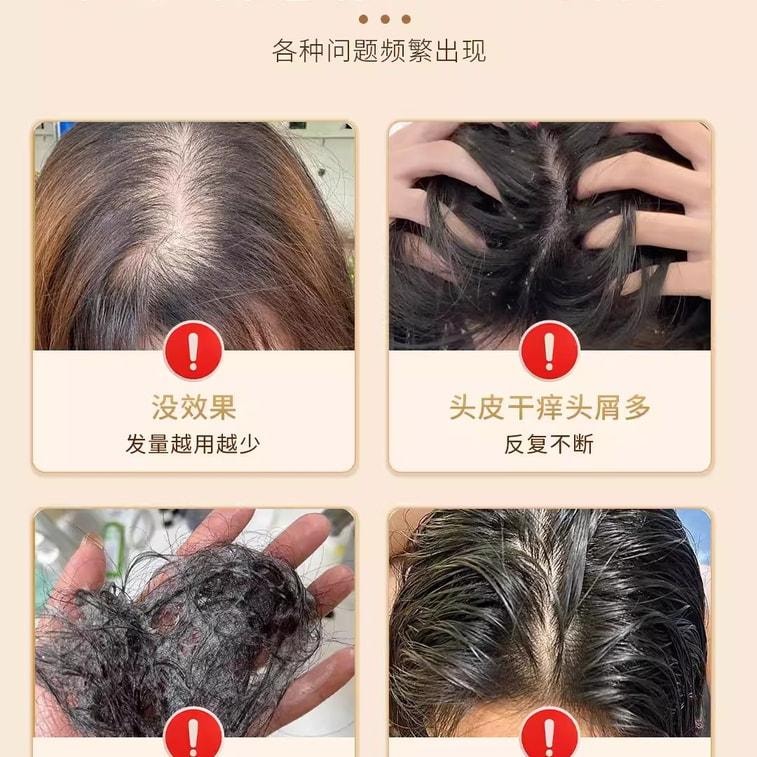 【中国直邮】 青幽堂 洗发水润养苗坚防脱洗发水丰盈固发养发育发苗坚防脱育发洗发水 400ml/瓶