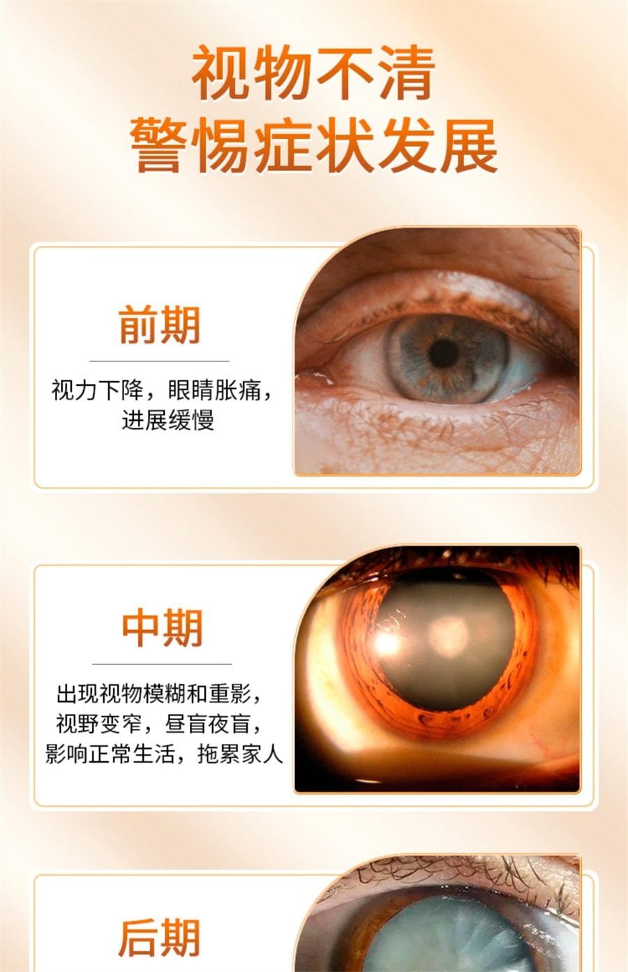 【中国直邮】 太极 拨云退翳丸 散风明目 消障退翳 用于目翳外障视物不清隐痛流泪 10袋/盒