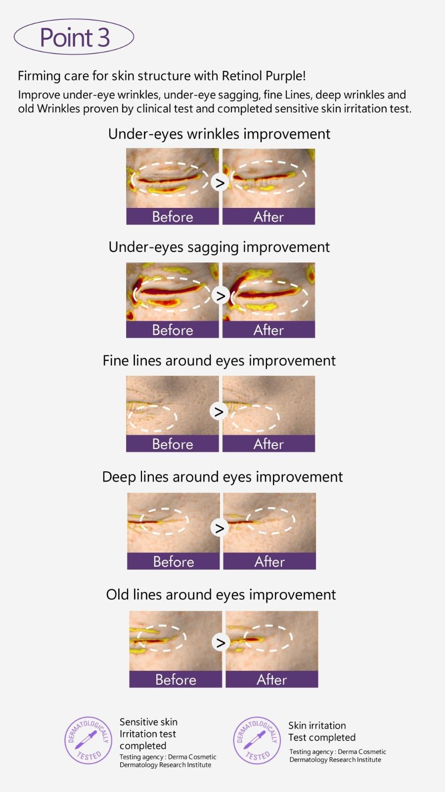 Retinol 500 Eye Cream Duo & Galvanic Device