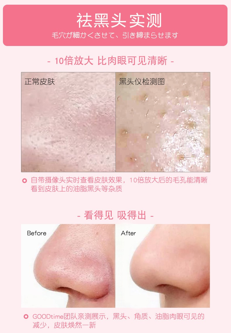 【中国直邮】北欧欧慕 可视化黑头洁面仪电动毛孔清洁器 白色款