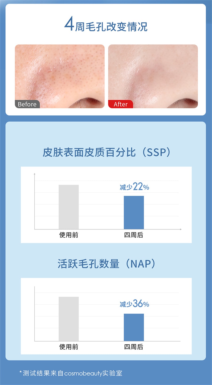 【中國直郵】DOCO小氣泡吸黑頭儀毛孔清潔神器 灰色