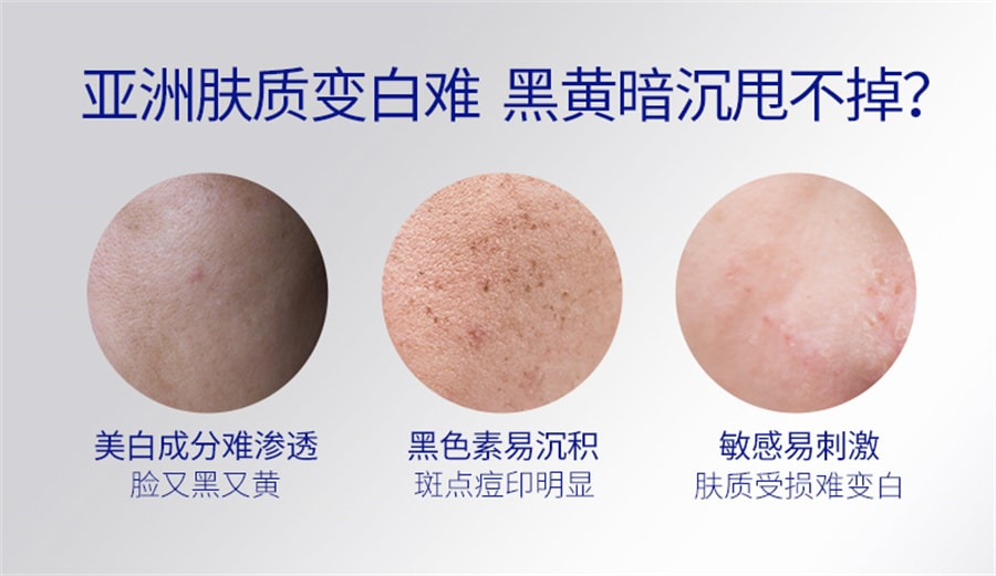 中國 肌膚未來377 美白面霜淡化色斑男女士提亮膚色補水保濕滋潤夏秋季 30g