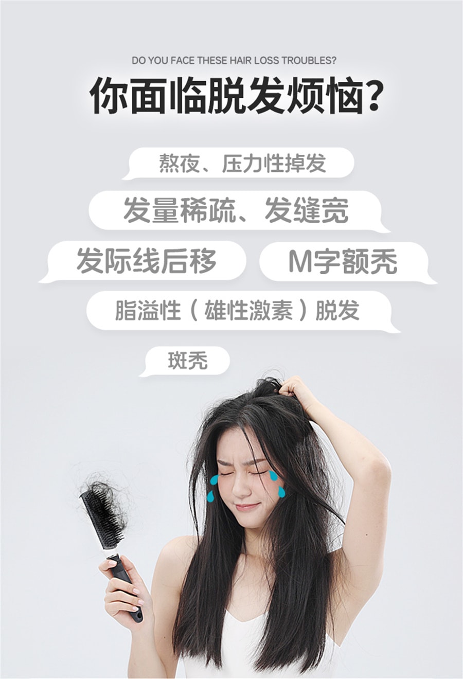 【中国直邮】斯必申  米诺地尔酊搽剂生发液女性2%防脱发生发液洗发水  100ml/瓶