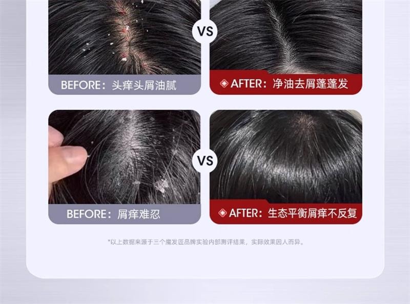 【中国直邮】 三个魔发匠 二硫化硒去屑洗发水毛囊清洁控油蓬松止痒洗头膏 400ml