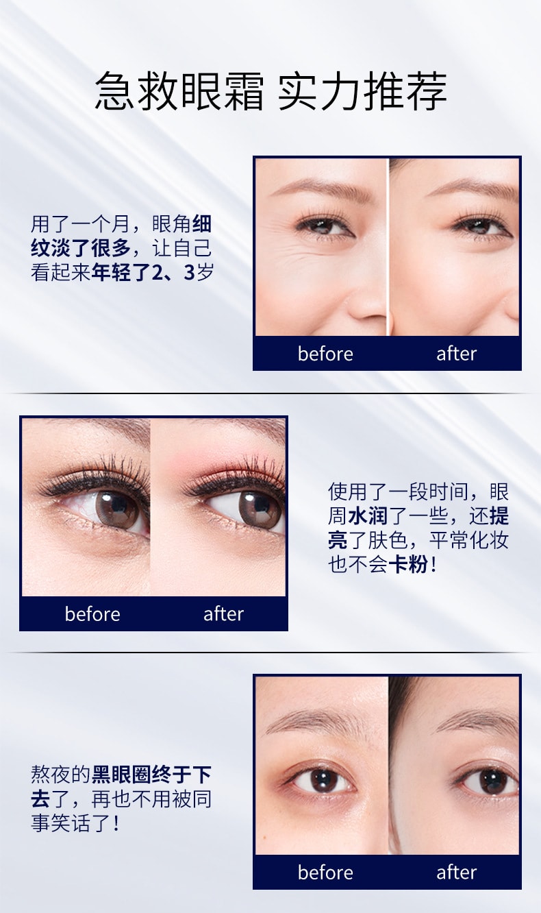 【中國直郵】修正 淡化細紋 黑眼圈 眼袋 抗皺 提拉緊緻修護眼霜 25g