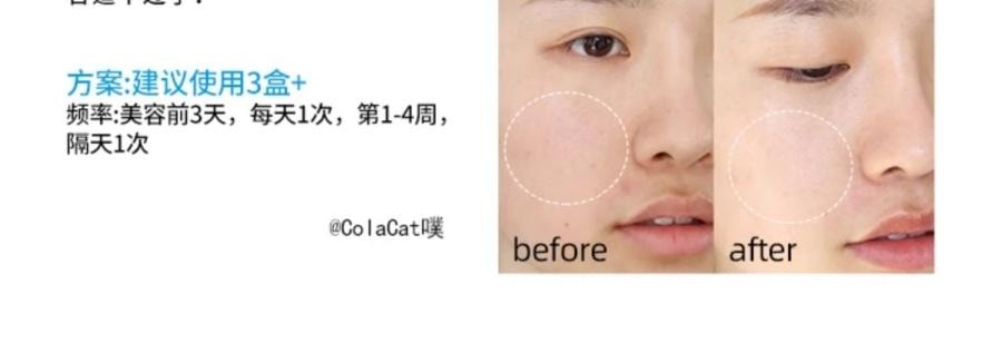 法国 理肤泉 B5多效保湿修护面膜 补水舒缓 5片入 敏感肌本命面膜 【李佳琦推荐】