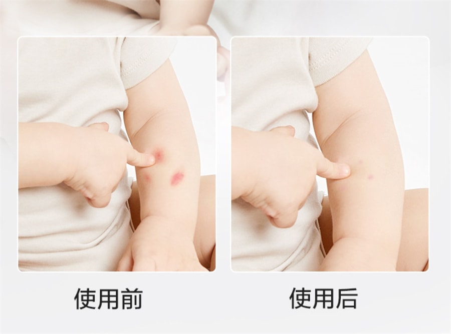 【中国直邮】 Bc Babycare babycare  紫草膏婴儿专用宝宝儿童孕妇驱蚊虫叮咬舒缓棒修护止痒膏   紫草膏6g/支