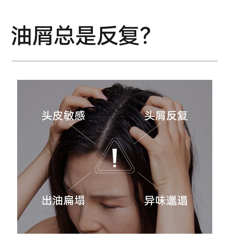 【中国直邮】 满婷 氨基酸控油去屑洗发乳250ml 去屑小蓝方 止痒清爽