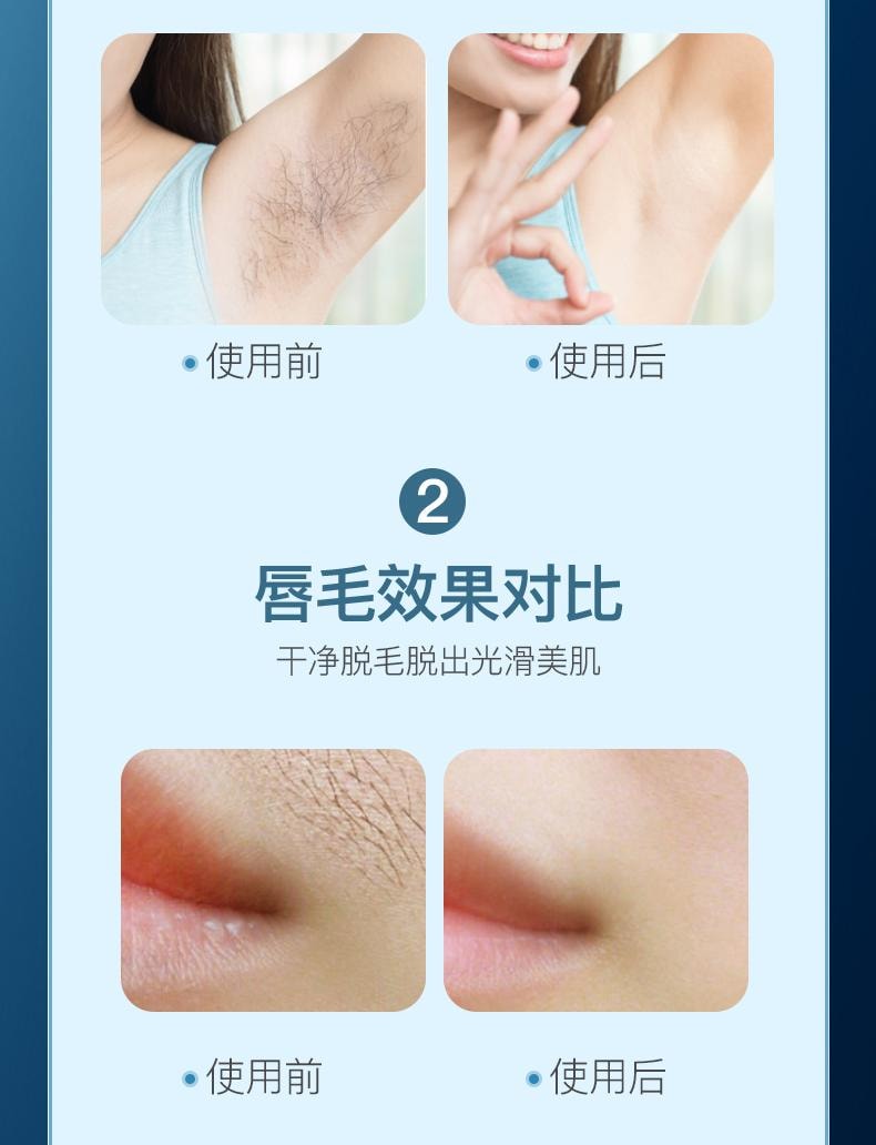 【中国直邮】 晶雅家 IPL冰点脱毛仪器家用胡子腋下私处全身去毛电动冰感激光脱毛器 冰雾蓝色 一套装