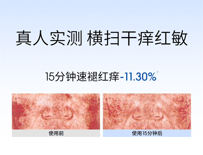 【中國直郵】 ddg 維生素B5煥活保濕修護精華 補水保濕維穩修護 30g/瓶【滋潤版】