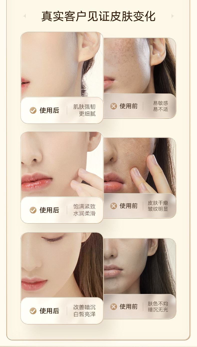 中國Droe大排燈家用美容儀臉部祛痘美白光子嫩膚面膜儀 白色 1件