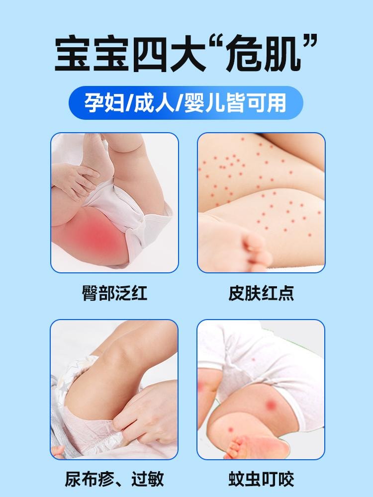 【中國直郵】 恆醫森 爐甘石濕疹洗劑 嬰兒專用 痱子皮膚搔癢止癢抑菌洗液80ml/瓶