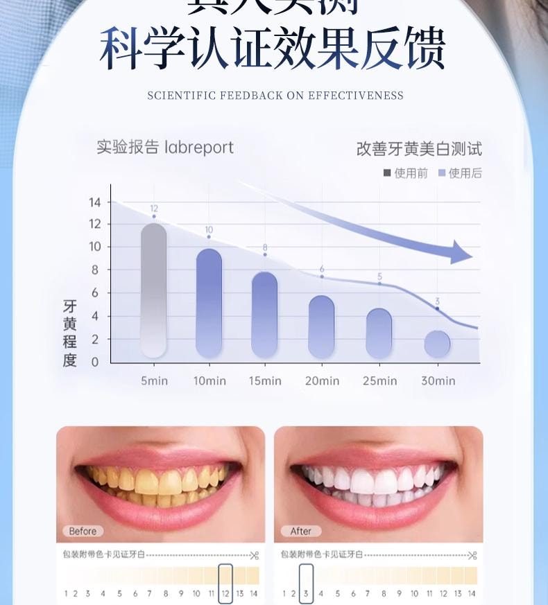爱兰歌娜 377美白牙贴7对/盒 【黑五大促】 20倍焕白亮牙去黄 强效洁白 天猫牙贴榜单第一  清洁牙渍烟茶咖啡渍 速白神器