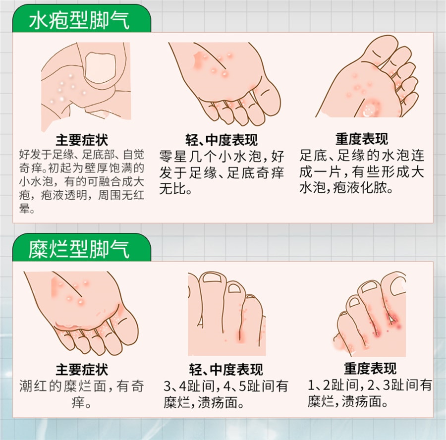 美国 丁克 盐酸特比萘芬喷雾剂去脚臭治脚气止痒脱皮杀菌股藓汗斑专用药15ml*2瓶 x 1盒