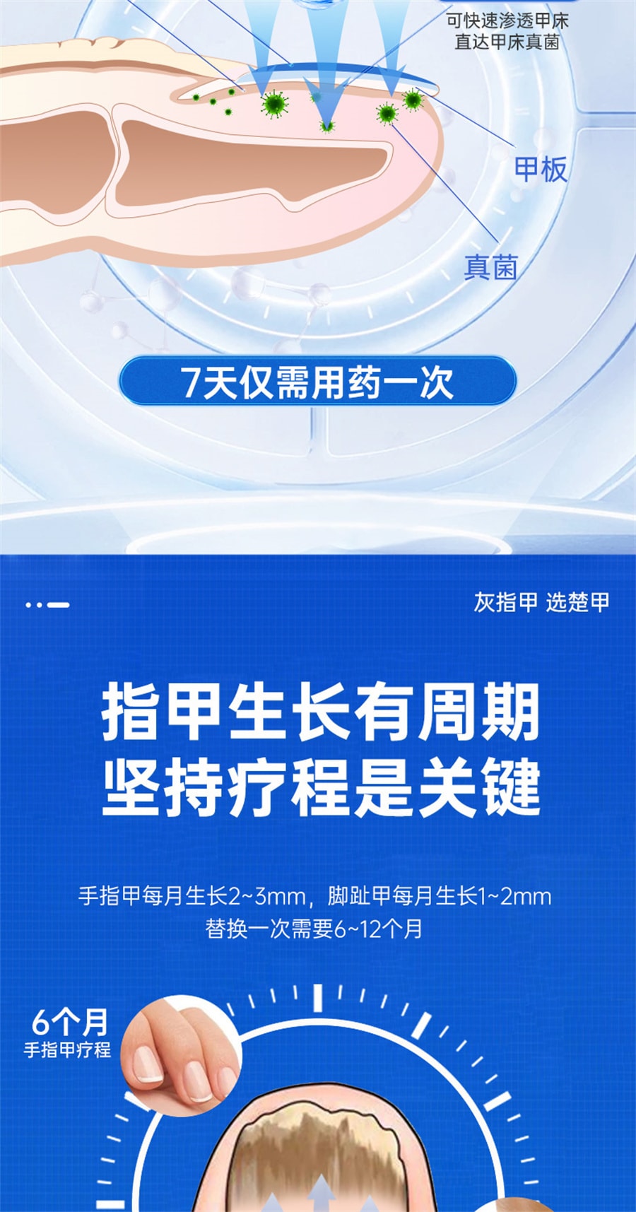 【中国直邮】楚甲  盐酸阿莫罗芬搽剂灰指甲专用药特效  2ml/盒
