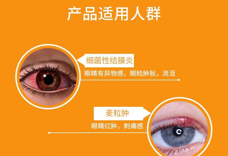 【中国直邮】双吉 盐酸金霉素眼膏 抗菌消炎 治疗沙眼眼部干涩眼睛红肿2.5g/盒