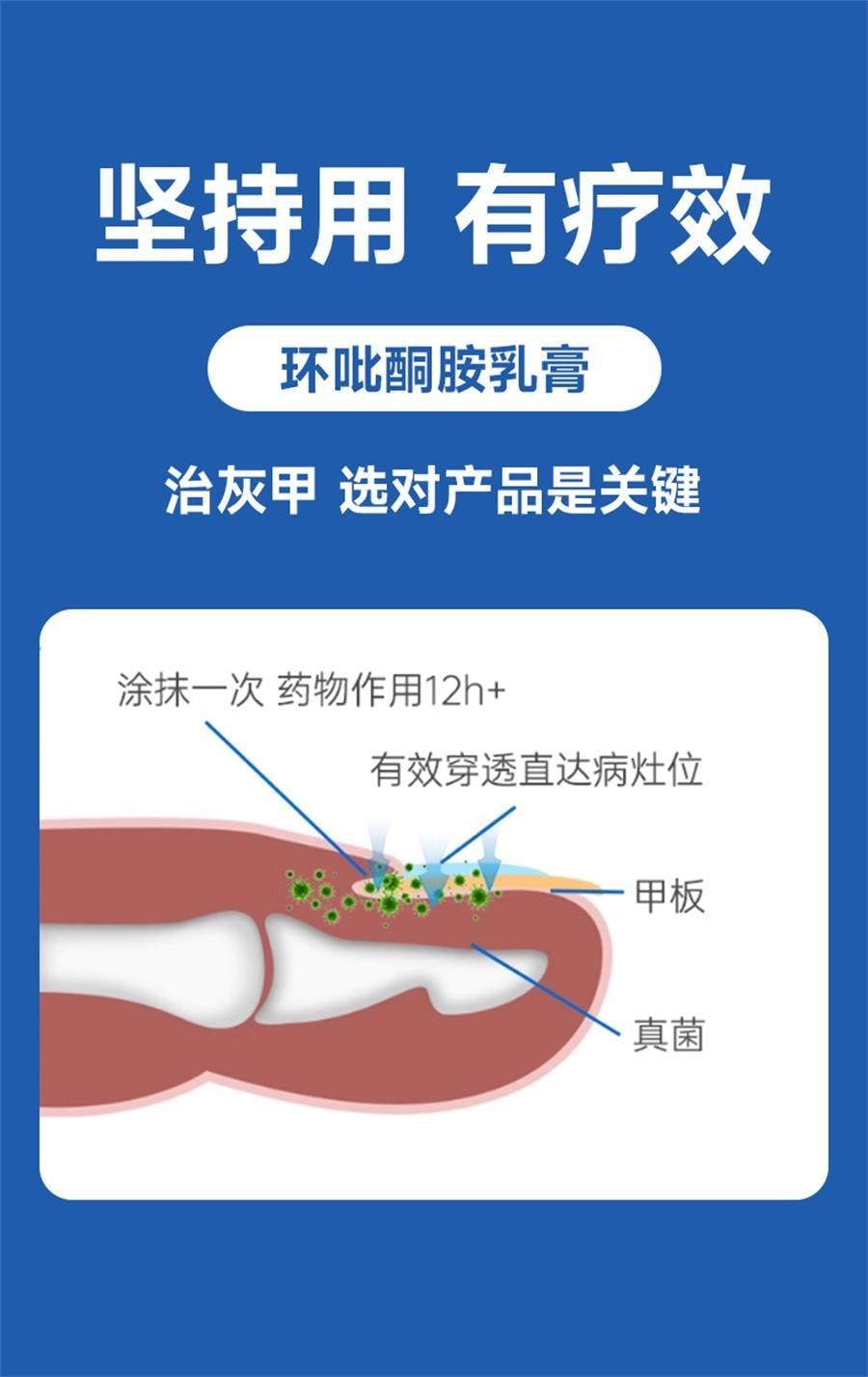 【中国直邮】 恒医森 环吡酮胺乳膏 治疗灰指甲专用药环比癣症真菌脚气止痒脱皮杀菌药水 20g/支