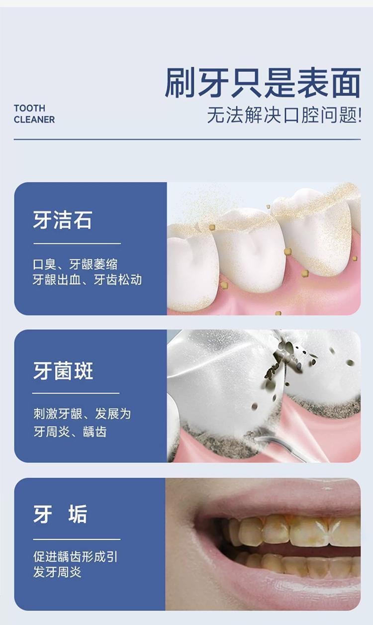【中国直邮】超声波除牙石洗牙器洁牙器牙垢牙结石去除器洁牙仪电动美牙仪  皓月白