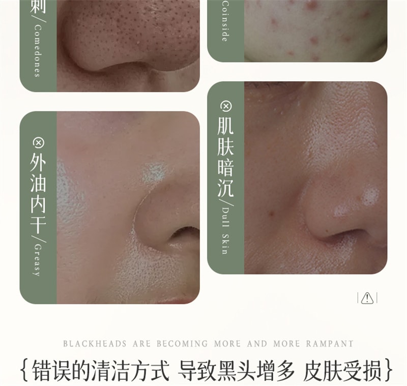 【中国直邮】 儒意 多酸净颜清肤泥膜 去黑白头闭口粉刺收缩深层清洁毛孔涂抹式积雪草清洁面膜 150g/瓶