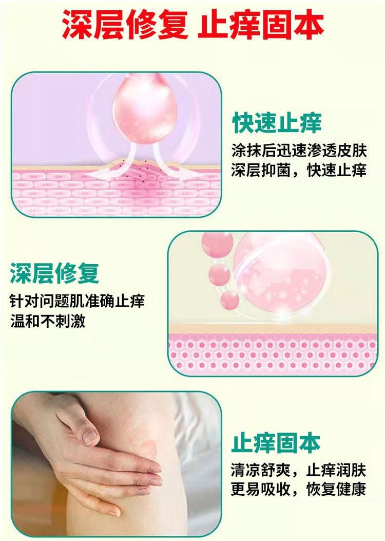 中国 严和 云南百癣王药膏 用于皮肤手足关节癣20g/瓶