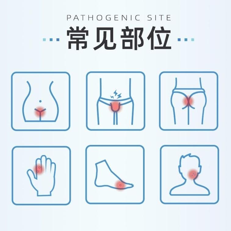 【中国直邮】  丽芙 咪喹莫特乳膏扁平疣丝状疣尖锐湿疣咪喹莫特乳膏涂 8袋/盒