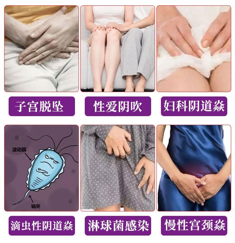 祥医堂 雌激素雌三醇软膏乳霜私处专用阴道干涩天然更年期外用 妇三醇乳膏15g