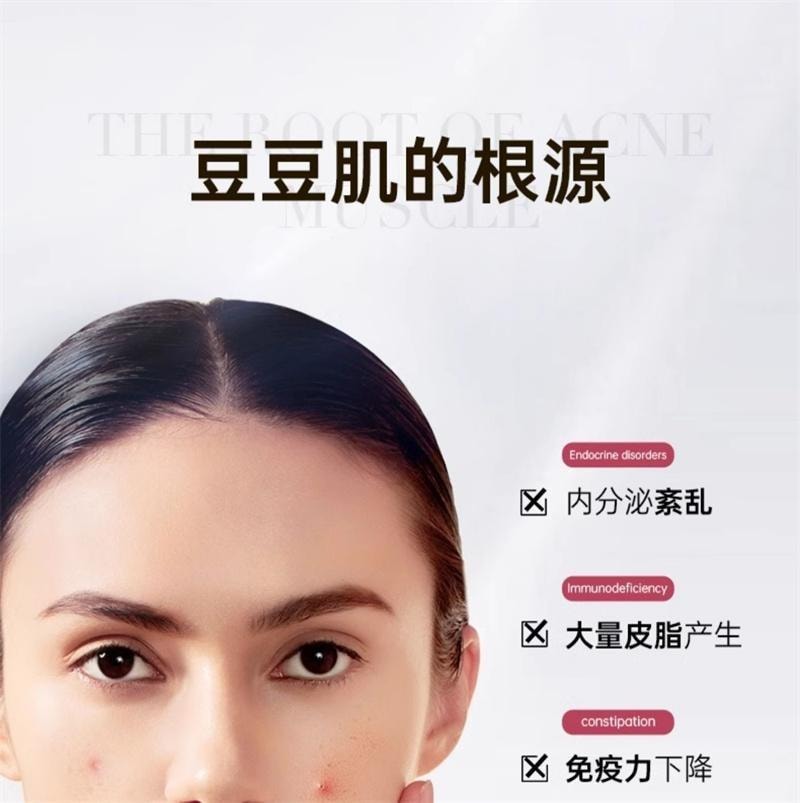 【中国直邮】 碧维斯 净痘胶囊 男女控油净痘粉刺淡化痘印收缩毛孔 60粒/盒