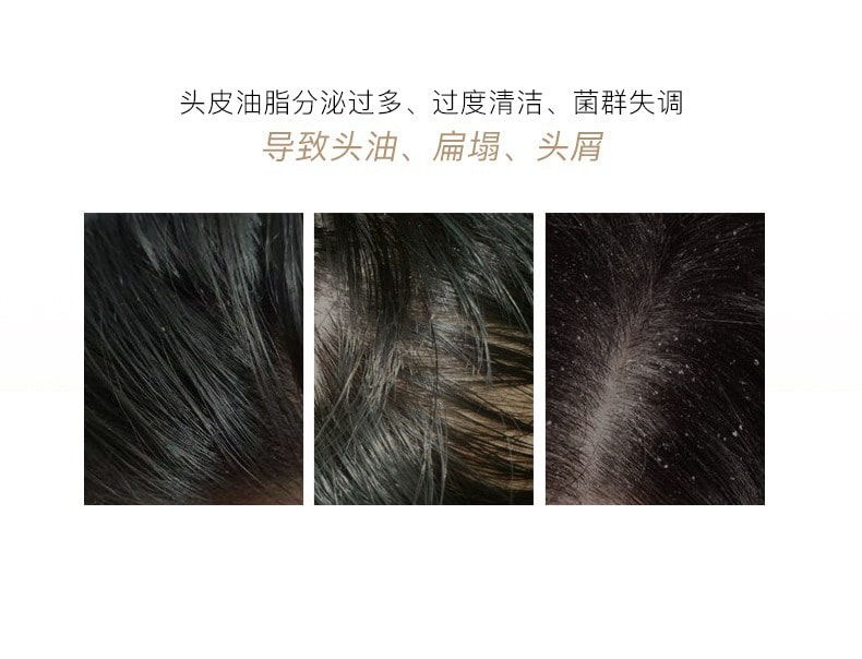 【中國直郵】RNW 去屑留香氨基酸洗髮精洗髮精+控油護髮素 300+200ml