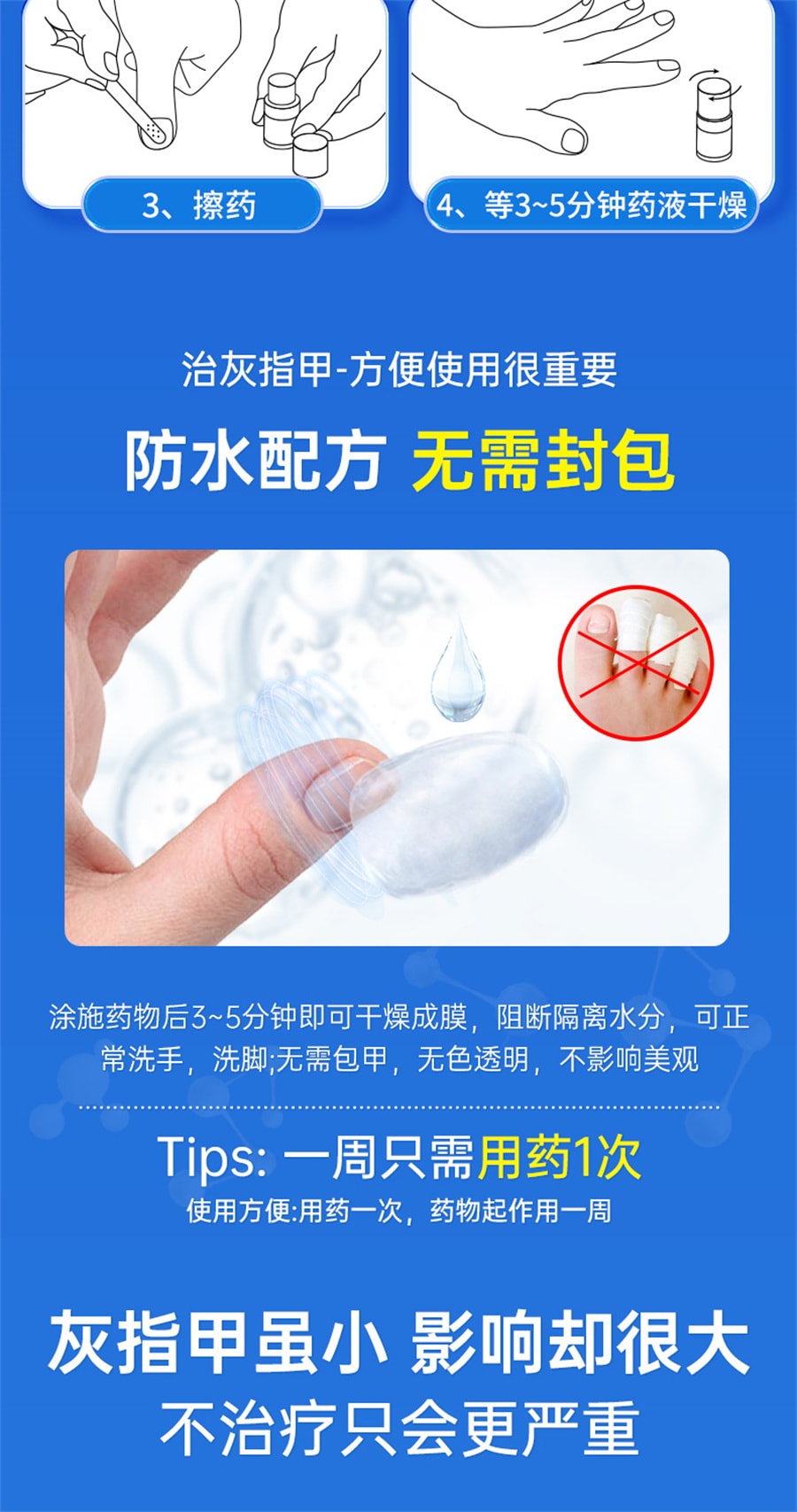 【中国直邮】楚甲  盐酸阿莫罗芬搽剂灰指甲专用药特效  2ml/盒