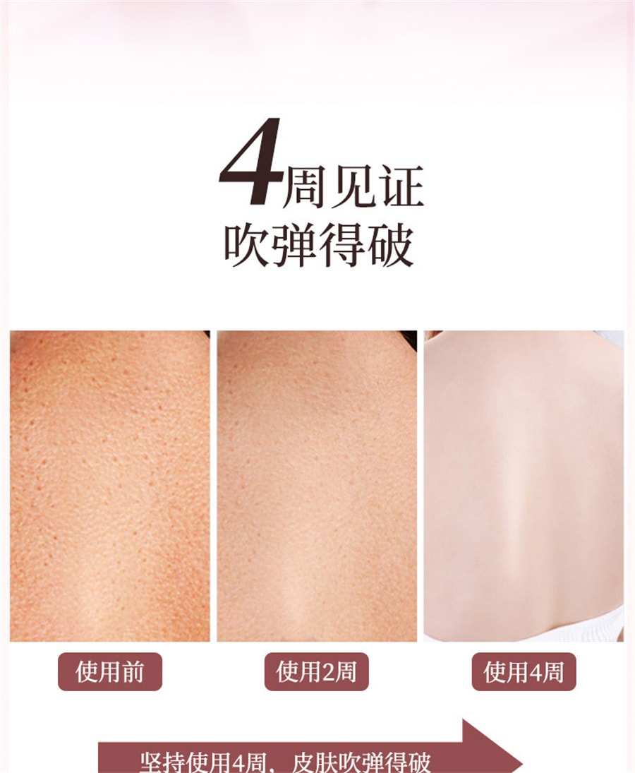 【中国直邮】舒奈美 私处粉嫩去除淡化沉淀黑色素私密处乳晕大腿内侧嫩红乳头变粉护理 50ml
