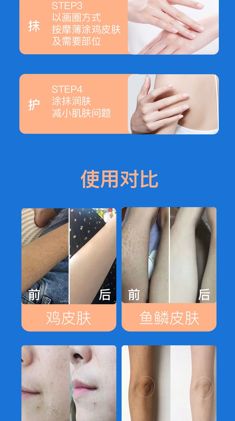 臻羞 小红书爆款组合 维E尿素乳霜30g+维A焕颜乳霜30g 去黑色素去鸡皮去黑头祛痘  日夜CP