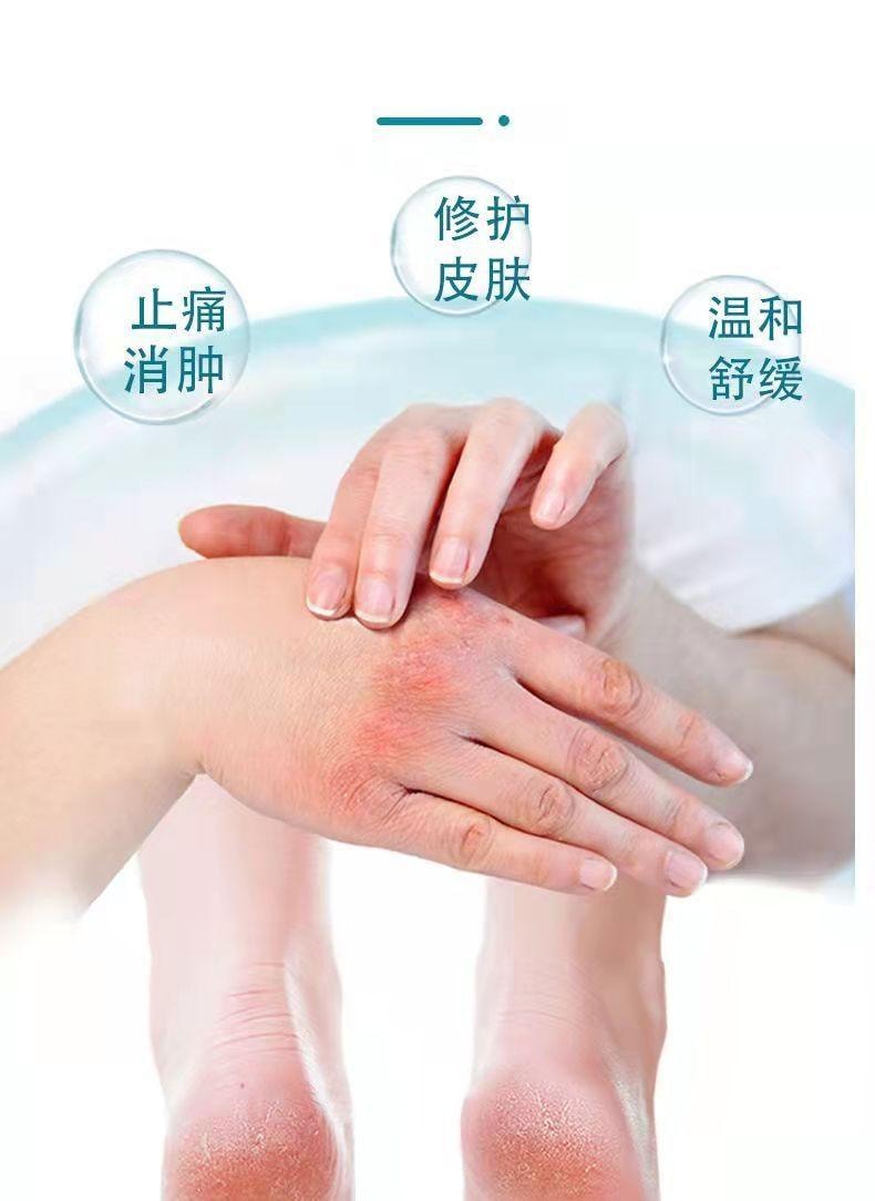  祥醫堂 獾油燙傷膏15g/盒 修護肌膚、止痛消腫、溫和舒緩、燙傷燒傷疤痕膏