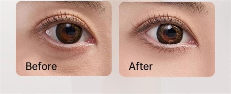 【中国直邮】 博拉利 眼部按摩仪护眼缓解疲劳雾化热敷蒸汽 中医穴位+润眼液 1台