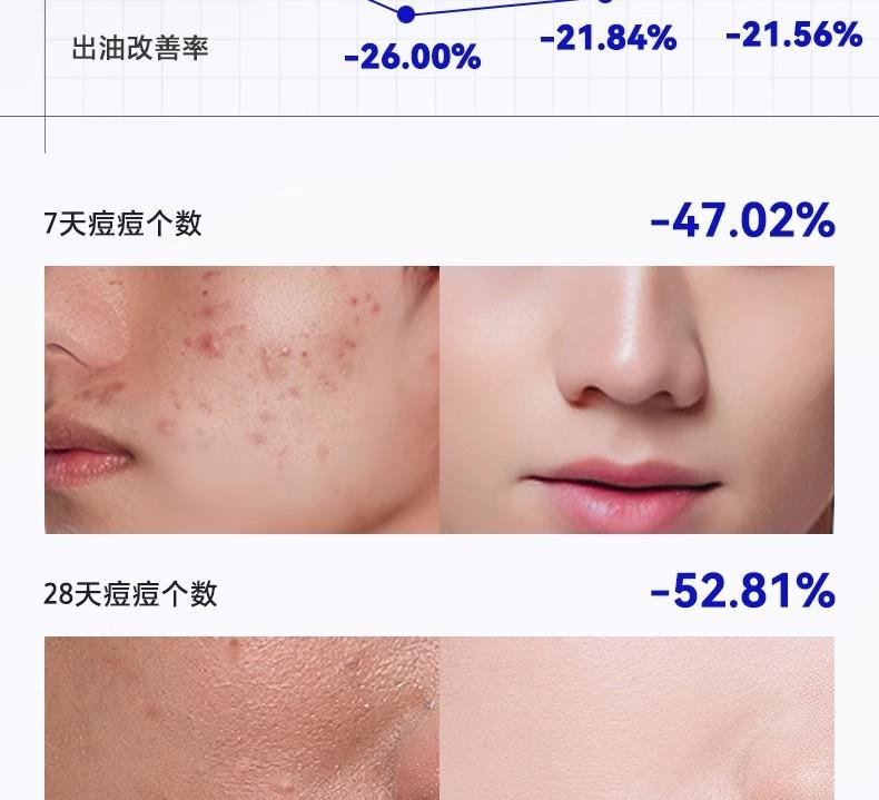 【中國直郵】 海洋至尊 三角鏡祛痘洗面乳 男士專用控油清潔黑頭氨基酸潔面乳 150g/瓶