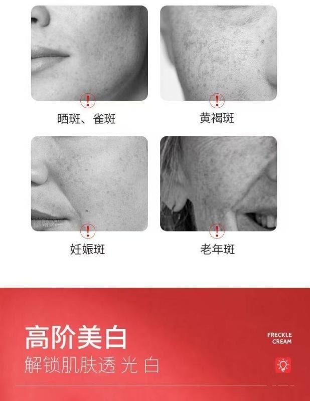 【中國直郵】 泊蝶 煙醯胺美白祛斑霜 淡斑去老年斑色斑雀斑保濕面霜乳 20g